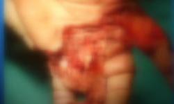 Hrvatska - sustav koji ne zna zabraniti petarde, prevenirati ozlijede niti napisati kazne?